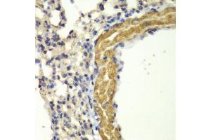 Immunohistochemistry of paraffin-embedded mouse lung using PRKG1 antibody (ABIN5971390) at dilution of 1/100 (40x lens). (PRKG1 抗体)
