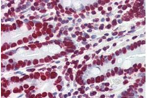 Human Small Intestine (formalin-fixed, paraffin-embedded) stained with HMGA1 antibody ABIN364402 at 4 ug/ml followed by biotinylated anti-goat IgG secondary antibody ABIN481715, alkaline phosphatase-streptavidin and chromogen. (HMGA1 抗体  (AA 12-23))