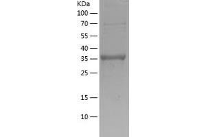 GDF5 Protein (AA 382-501) (His-IF2DI Tag)