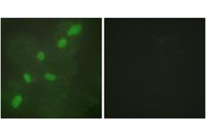 Immunofluorescence analysis of HeLa cells, using hnRNP A2/B1 Antibody. (HNRNPA2B1 抗体  (AA 1-50))
