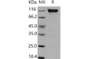 Western Blotting (WB) image for Interleukin 6 Signal Transducer (Gp130, Oncostatin M Receptor) (IL6ST) (Active) protein (His tag,Fc Tag) (ABIN7196601) (CD130/gp130 Protein (His tag,Fc Tag))