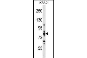 Western blot analysis in K562 cell line lysates (35ug/lane). (CPT1A 抗体  (C-Term))
