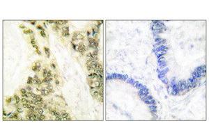 Immunohistochemistry (IHC) image for anti-Thyroid Hormone Receptor, alpha (THRA) (N-Term) antibody (ABIN1848805) (THRA 抗体  (N-Term))