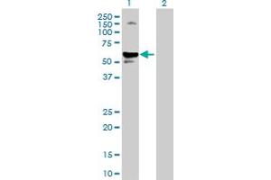 Lane 1: SERPINA1 transfected lysate ( 46. (SERPINA1 293T Cell Transient Overexpression Lysate(Denatured))