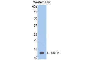 Western blot analysis of recombinant Human HPA. (HPSE 抗体  (AA 34-115))