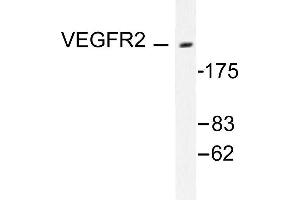 Image no. 1 for anti-VEGF Receptor 2 (VEGFR2) antibody (ABIN271861) (VEGFR2/CD309 抗体)