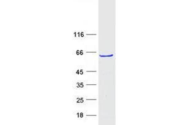 ZNF213 Protein (Transcript Variant 1) (Myc-DYKDDDDK Tag)