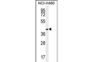 Western blot analysis in NCI-H460 cell line lysates (35ug/lane). (GGH 抗体  (C-Term))