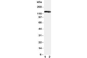 Western blot testing of COL2A1 antibody and Lane 1:  rat heart;  2: rat brain tissue lysate. (COL2A1 抗体  (C-Term))