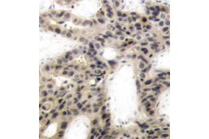 Immunohistochemistry (IHC) image for anti-Eukaryotic Translation Initiation Factor 4E Binding Protein 1 (EIF4EBP1) (pThr45) antibody (ABIN1870151) (eIF4EBP1 抗体  (pThr45))