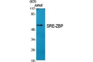 Western Blotting (WB) image for anti-Zinc Finger Protein 187 (ZNF187) (Internal Region) antibody (ABIN3187053) (ZNF187 抗体  (Internal Region))