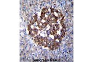 Immunohistochemistry (IHC) image for anti-Protocadherin 20 (PCDH20) antibody (ABIN2996299) (PCDH20 抗体)