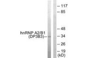 Western blot analysis of extracts from HepG2 cells, using hnRNP A2/B1 Antibody. (HNRNPA2B1 抗体  (AA 1-50))