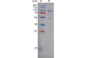 Human Protein, His Tag on SDS-PAGE under reducing condition. (P-Cadherin Protein (CDH3) (AA 18-654) (His tag))