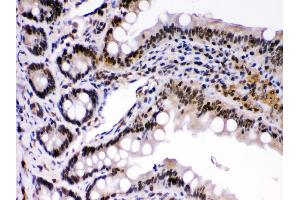 Immunohistochemistry (Paraffin-embedded Sections) (IHC (p)) image for anti-REL proto-oncogene (c-Rel) (AA 268-306), (Middle Region) antibody (ABIN3043314) (c-Rel 抗体  (Middle Region))