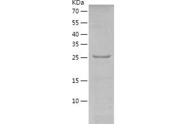 PROSC Protein (AA 1-275) (His tag)