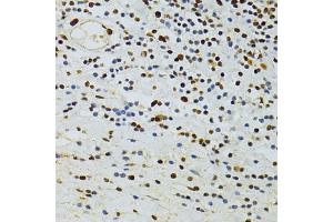 Immunohistochemistry of paraffin-embedded human vermiform appendix using ALYREF antibody (ABIN5973579) at dilution of 1/100 (40x lens). (THO Complex 4 抗体)