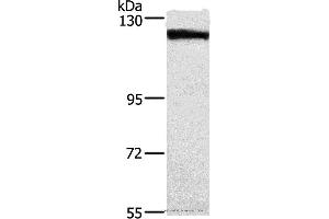 Western blot analysis of Human tongue cancer tissue, using DSG1 Polyclonal Antibody at dilution of 1:750 (Desmoglein 1 抗体)