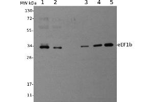 Image no. 1 for anti-Eukaryotic Translation Elongation Factor 1 beta 2 (EEF1B2) antibody (ABIN334557) (EEF1B2 抗体)