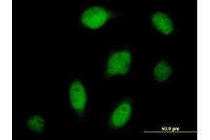 Immunofluorescence of purified MaxPab antibody to CPSF3 on HeLa cell. (CPSF3 抗体  (AA 1-684))