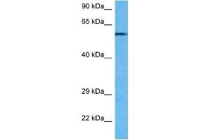 Host:  Rabbit  Target Name:  PPP3CA  Sample Tissue:  Mouse Heart  Antibody Dilution:  1ug/ml (PPP3CA 抗体  (N-Term))