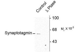Image no. 1 for anti-Synaptotagmin I (SYT1) (pSer309) antibody (ABIN372725) (SYT1 抗体  (pSer309))