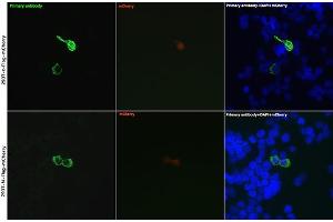 Immunofluorescence analysis of 293T cells transfected with Flag-c(mCherry) and 293T cells transfected with Flag-N(mCherry) use Rabbit anti DDDDK-Tag pAb (ABIN1512924 and ABIN5663537) at dilution of 1:50 (40x lens). (DYKDDDDK Tag 抗体)