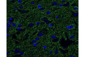 Indirect immunostaining of PFA fixed, paraffin embedded mouse brain (dilution 1 : 500; green). (Tubulin delta 2 (AA 443-449) 抗体)