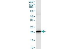 Immunoprecipitation of IL17C transfected lysate using anti-IL17C MaxPab rabbit polyclonal antibody and Protein A Magnetic Bead , and immunoblotted with IL17C MaxPab mouse polyclonal antibody (B01) . (IL17C 抗体  (AA 1-197))