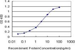 Detection limit for recombinant GST tagged RORB is approximately 0. (RORB 抗体  (AA 136-224))