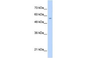 PGS1 antibody used at 0. (PGS1 抗体  (C-Term))