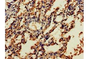 Immunohistochemistry of paraffin-embedded human lung tissue using ABIN7161677 at dilution of 1:100 (NOG 抗体  (AA 28-232))