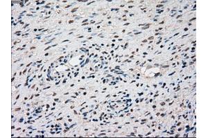 Immunohistochemical staining of paraffin-embedded Kidney tissue using anti-SSBmouse monoclonal antibody. (SSB 抗体)