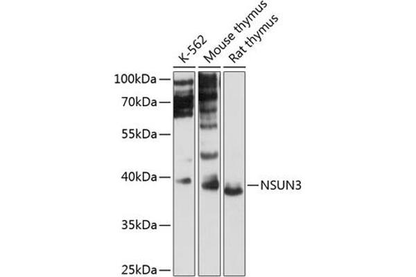 NSUN3 抗体  (AA 1-120)