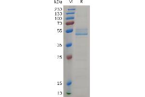 Cynomolgus MDK Protein,  hFc Tag on SDS-PAGE under reducing condition. (Midkine Protein (AA 23-143) (Fc Tag))