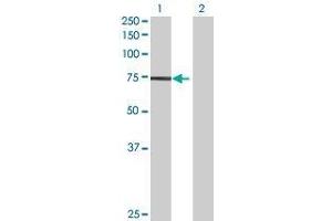 Lane 1: CDKL3 transfected lysate ( 65. (CDKL3 293T Cell Transient Overexpression Lysate(Denatured))