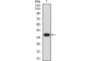 Western blot analysis using CD181 mAb against human CD181 recombinant protein. (CXCR1 抗体)