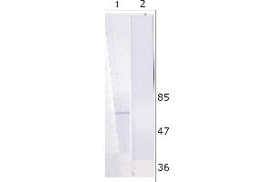 WB analysis of Huh-7 cell line expressing NS5B protein. (HCV 1b NS5B 抗体  (AA 92-105))