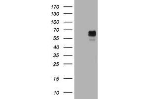 Image no. 2 for anti-Tyrosinase (TYR) (AA 19-320) antibody (ABIN1491083) (TYR 抗体  (AA 19-320))