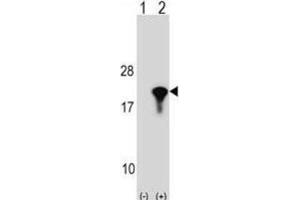 Western Blotting (WB) image for anti-Peptidylprolyl Isomerase (Cyclophilin)-Like 1 (PPIL1) antibody (ABIN2998971) (PPIL1 抗体)