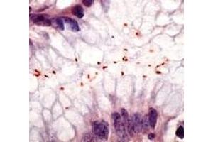 Formalin fixed paraffin embedded human stomach infected with H. (Helicobacter Pylori 抗体)