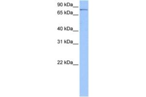 Western Blotting (WB) image for anti-Polyribonucleotide Nucleotidyltransferase 1 (PNPT1) antibody (ABIN2462319) (PNPT1 抗体)