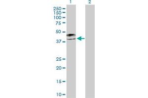 Western Blot analysis of KRT19 expression in transfected 293T cell line by KRT19 MaxPab polyclonal antibody. (Cytokeratin 19 抗体  (AA 1-400))