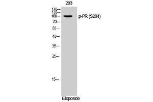 Western Blotting (WB) image for anti-PR (pSer294) antibody (ABIN3173167) (PR (pSer294) 抗体)