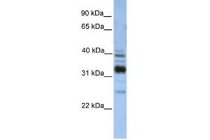 TXNDC13 antibody used at 1 ug/ml to detect target protein. (TMX4 抗体  (C-Term))