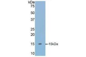 Detection of Recombinant TGFb1, Human using Polyclonal Antibody to Transforming Growth Factor Beta 1 (TGFb1) (TGFB1 抗体  (AA 279-390))