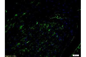 Immunofluorescence (IF) image for anti-Intercellular Adhesion Molecule 1 (ICAM1) (AA 201-300) antibody (ABIN670806)