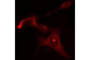 ABIN6275058 staining Hela cells by IF/ICC. (DGAT2L6 抗体  (C-Term))