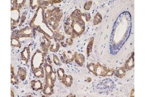 Immunohistochemistry (IHC) image for anti-Keratin 8 (KRT8) (C-Term) antibody (ABIN870549) (KRT8 抗体  (C-Term))