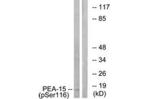 Western blot analysis of extracts from COS7 cells treated with INSULIN 0. (PEA15 抗体  (pSer116))